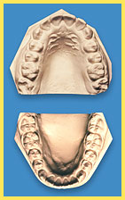 Mouth Breathing Correction - Arch Development with proper tongue function